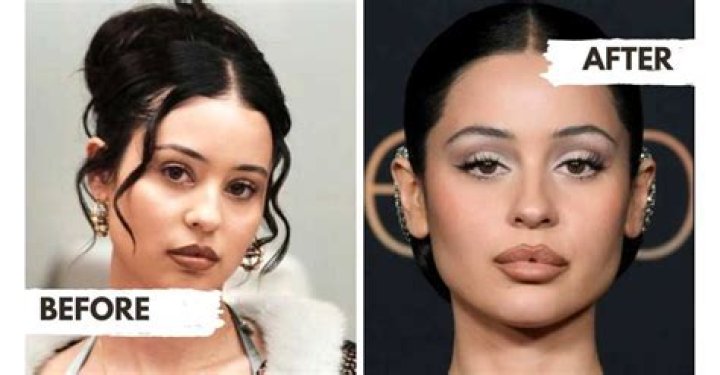 Alexa Demie before and after surgery