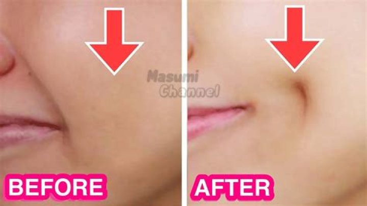 Dying To Get Dimples? Here Are 3 Simple Ways To Have One Without Any Surgery