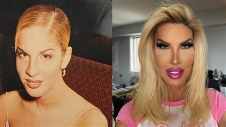 Nikki Exotika Plastic Surgery: Who Is Nikki Exotika?