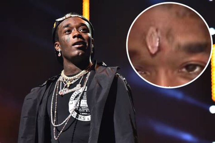 Rapper Lil Uzi Vert Reveals He Took His Forehead Diamond Implant From Rapper Lil B