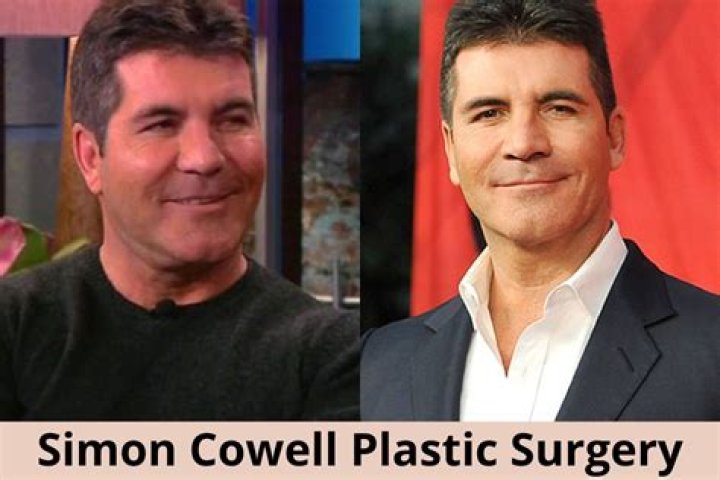 Simon Cowell Plastic Surgery: Who is Simon Cowell?