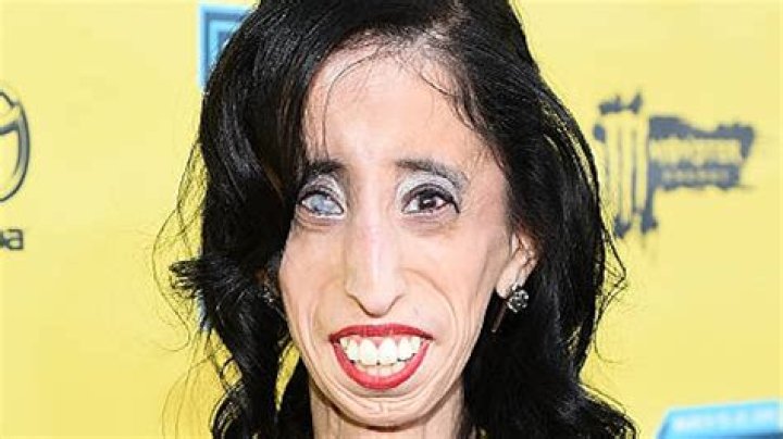Ugliest People 2023 - Who Is Ugliest Person In The World